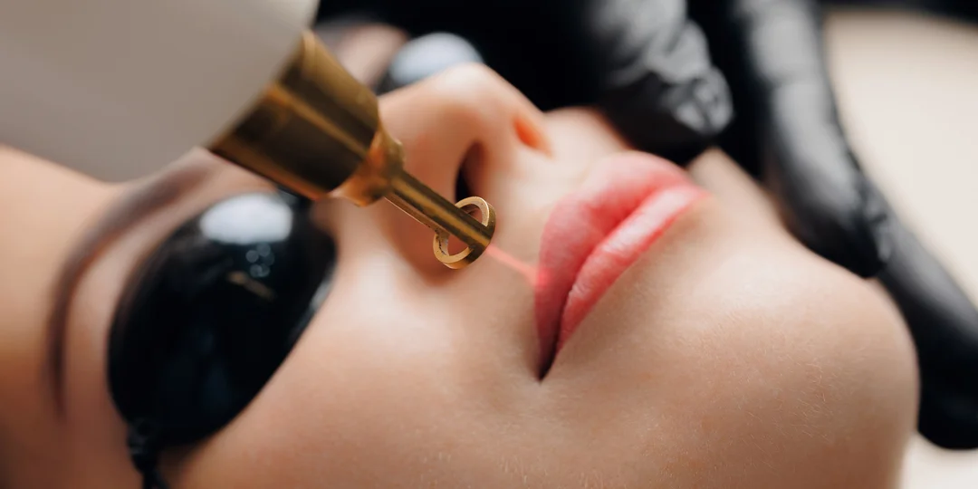 Laserové odstránenie tetovania alebo permanentného makeupu