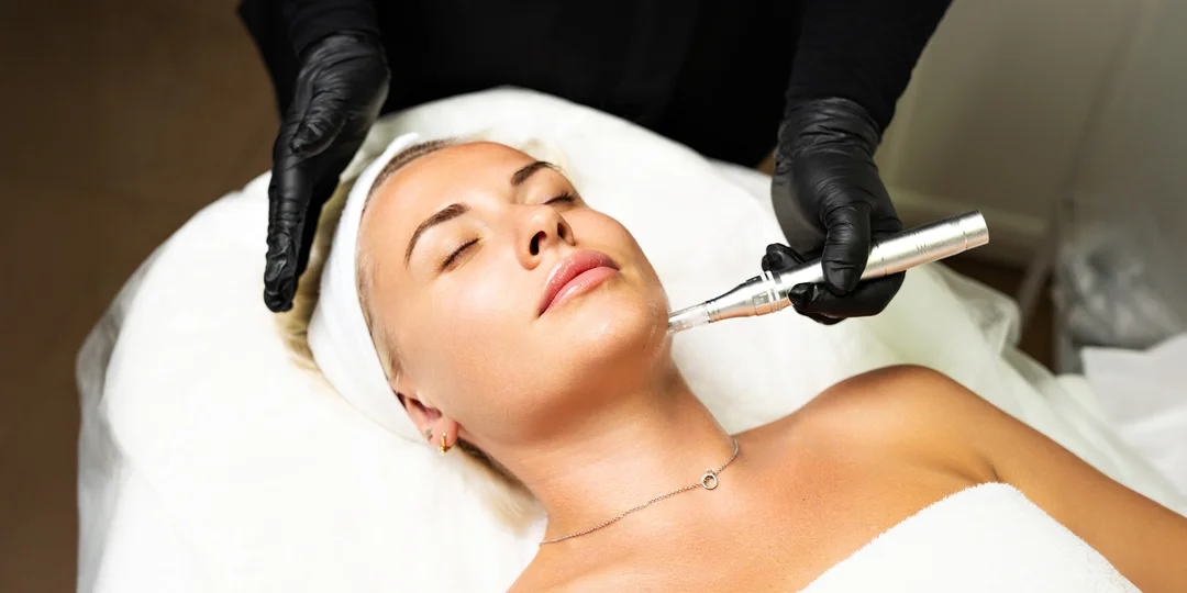 Účinné ošetrenia pre žiarivú pleť: Lososie spermie, karbónový laser aj microneedling