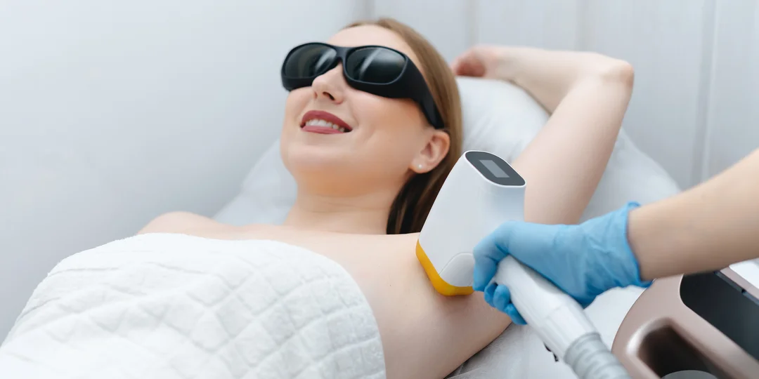 Trvalá epilácia diódovým laserom pre ženy aj mužov: rôzne oblasti tela