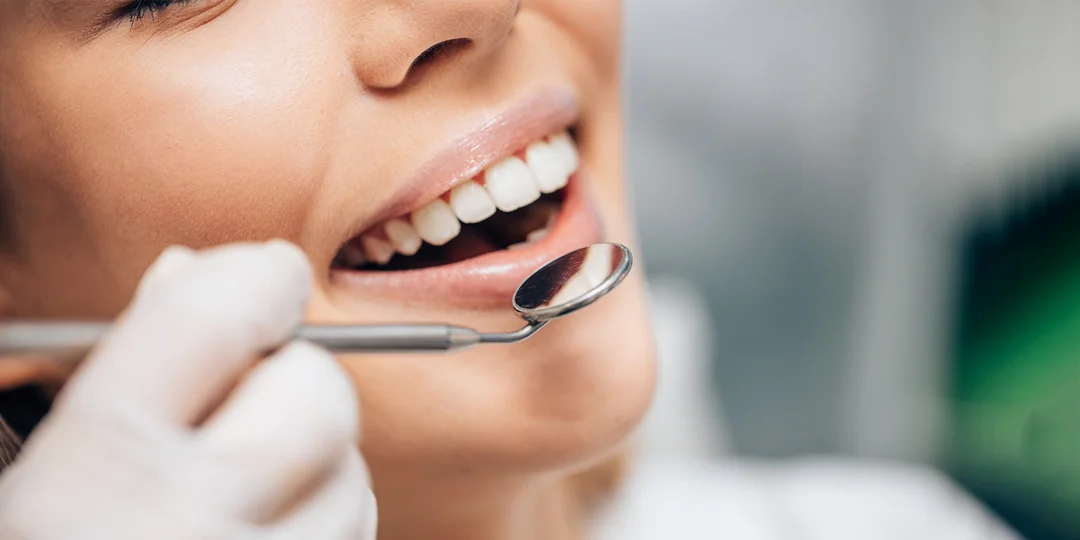 Profesionálna dentálna hygiena s pieskovaním pre deti i dospelých