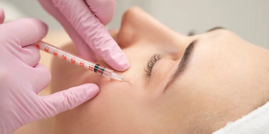 Účinná mezoterapia alebo bioregenerácia microneedling očného okolia