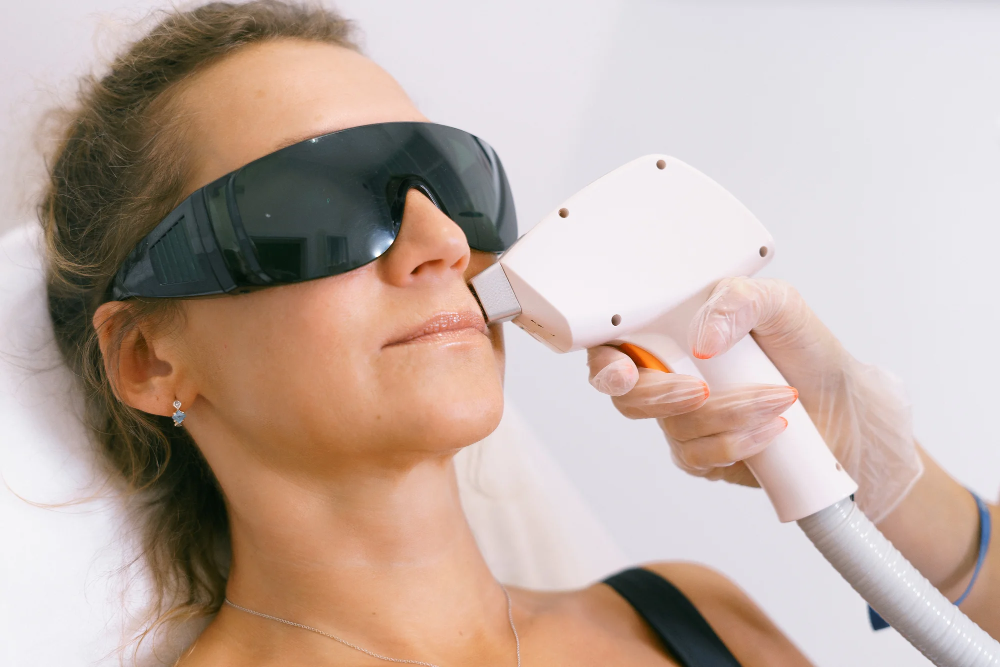 Trvalá laserová epilace pro ženy: bikiny, podpaží, nohy, ruce i obličej
