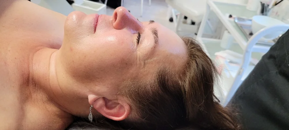 Zářivá pleť: Mikrojehličkové ošetření vč. světelné terapie