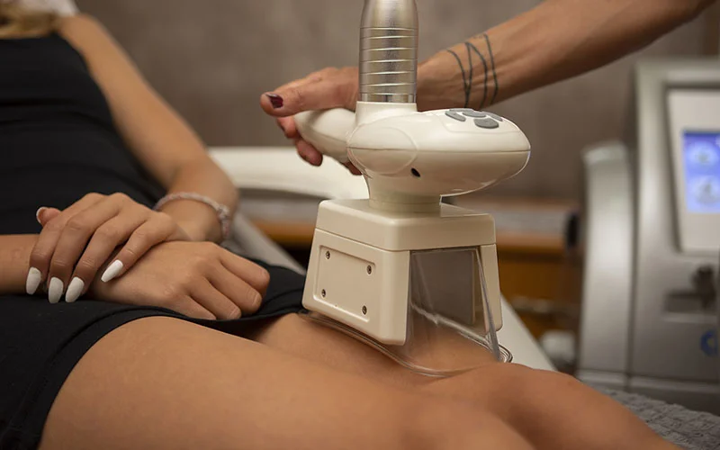 Štíhlá bezbolestně a bez diet – ošetření kryolipolýzou: 1, 3, 5 či rovnou 10 ošetření