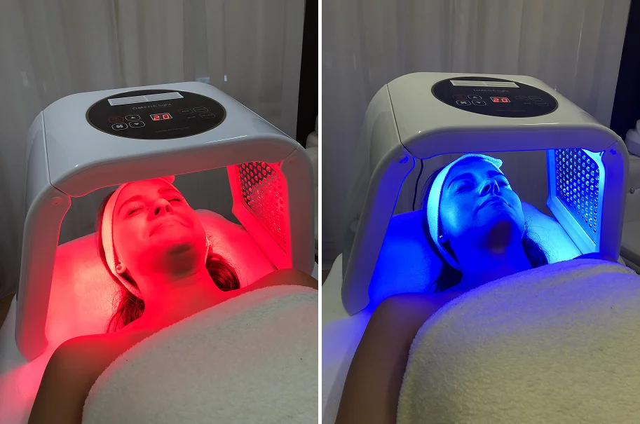 Diamantová mikrodermabraze, karbonový peeling nebo hloubkové čištění