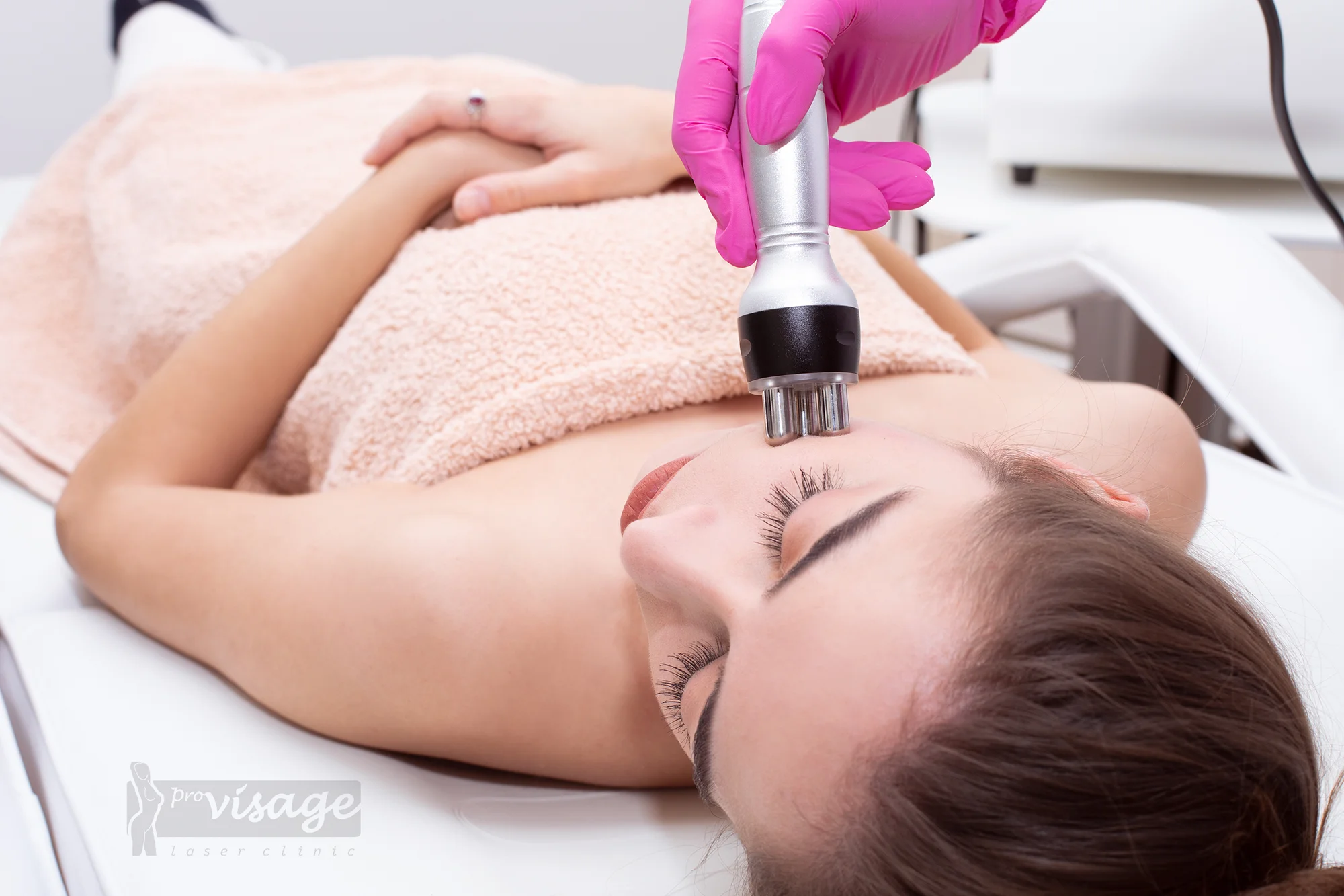 Diamantová mikrodermabraze, karbonový peeling nebo hloubkové čištění
