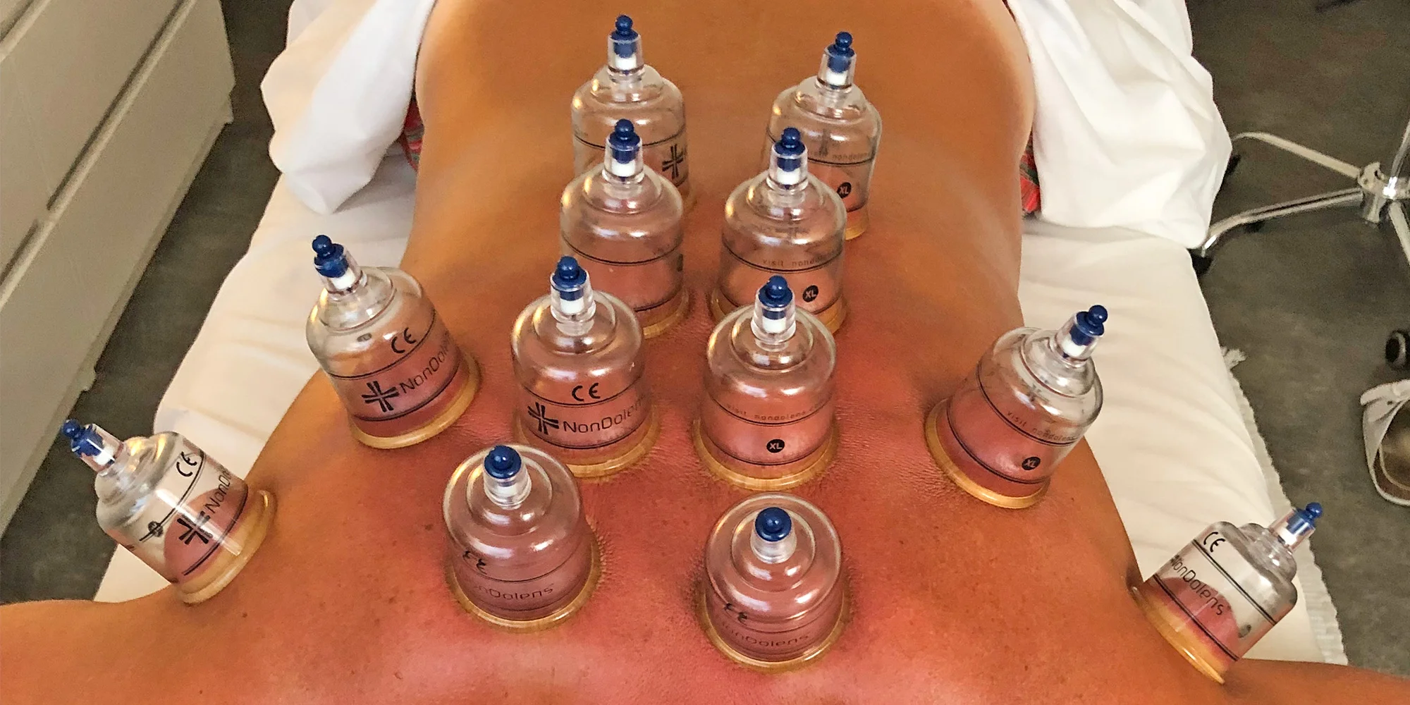 60 nebo 90min. kombinovaná masáž: olejová, trigger points, baňkování i tejpy