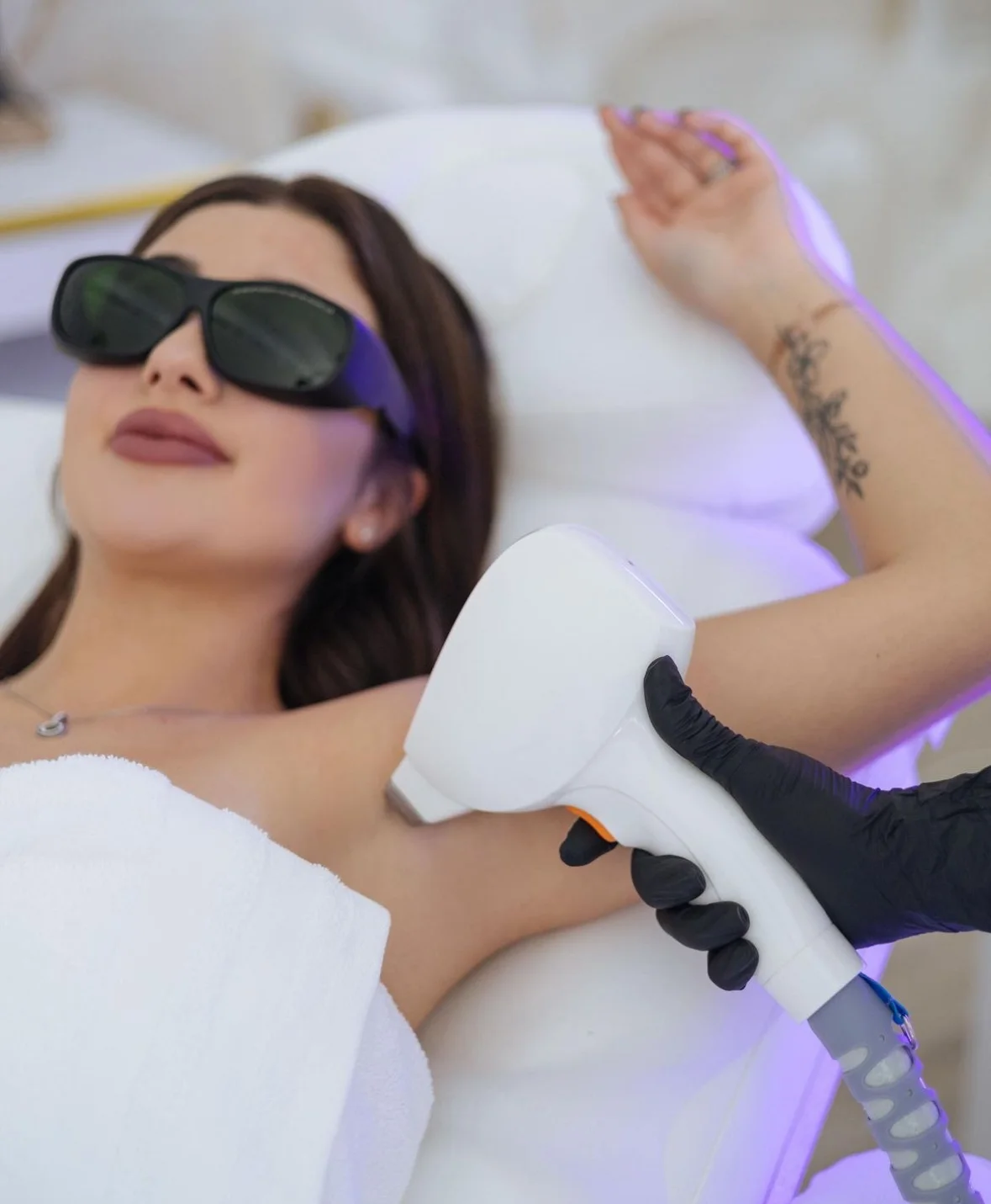 Laserová epilace vybraných partií: ret, podpaží, celé ruce, nohy i brazilka