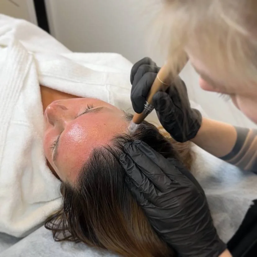 Omlazení pleti: lifting, ultrazvukové či manuální čištění, karboxyterapie, TC Plus peeling nebo mezoterapie