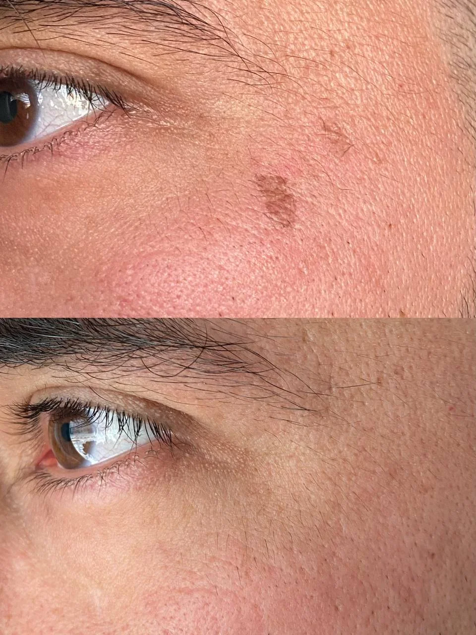 Omlazení pleti: lifting, ultrazvukové či manuální čištění, karboxyterapie, TC Plus peeling nebo mezoterapie