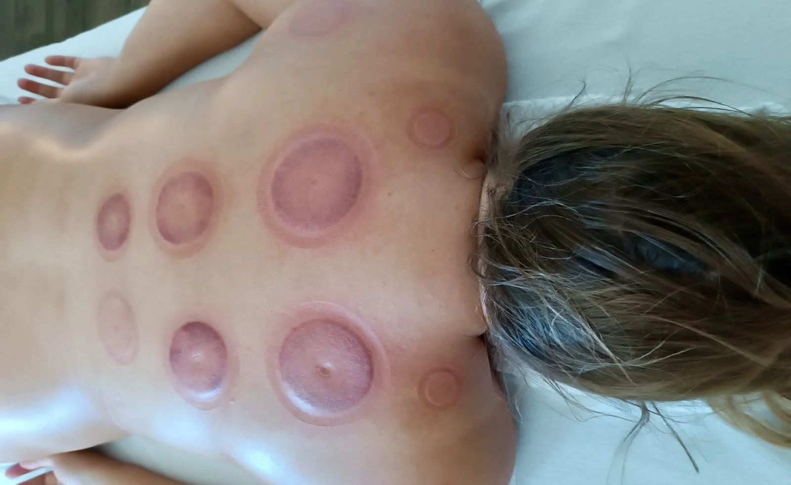 75 minut baňkování zad s masáží šíje nebo i nohou od masérky Adély Kišš