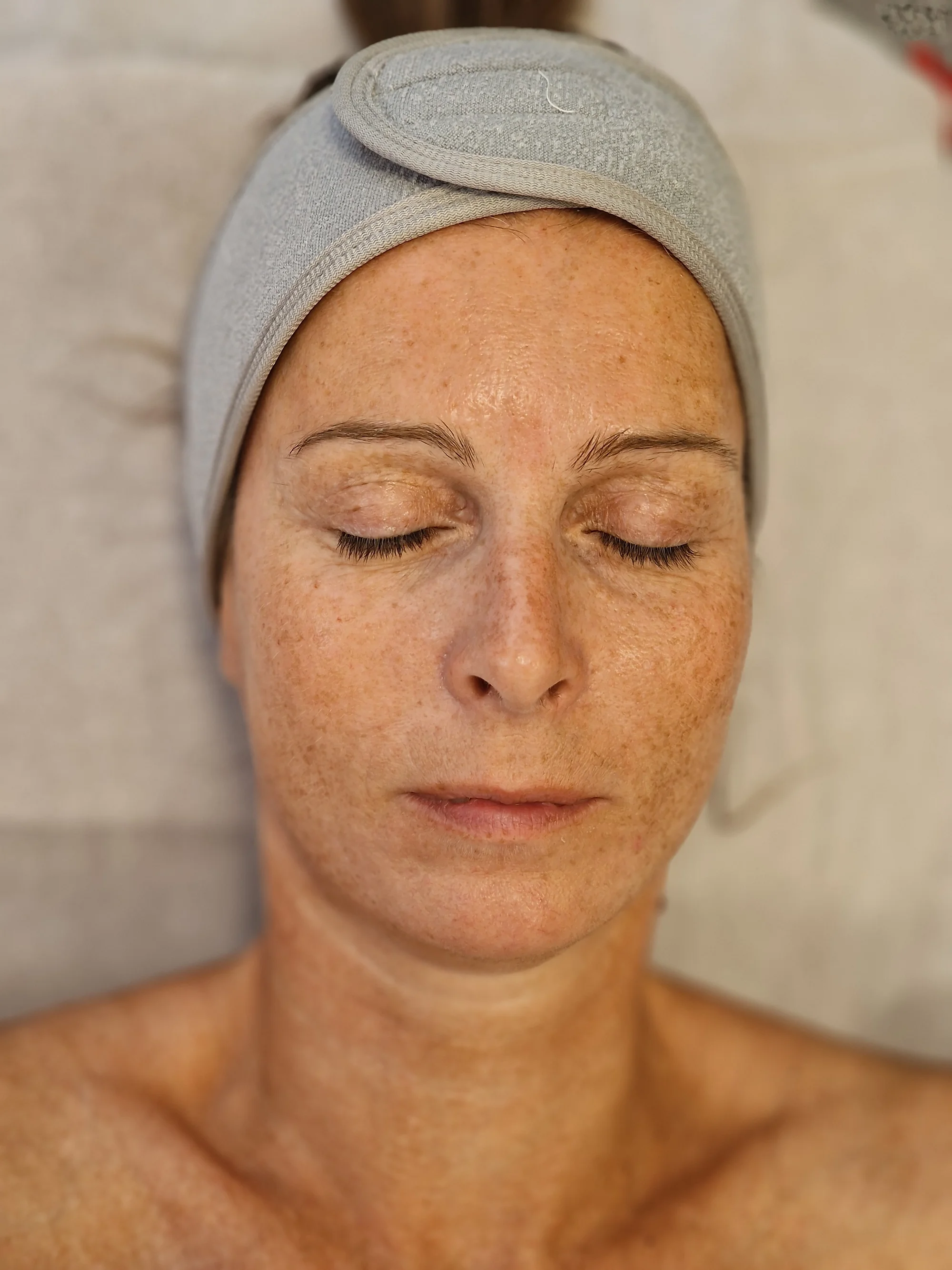 Anti-age kosmetické ošetření, chemický peeling i laminace obočí