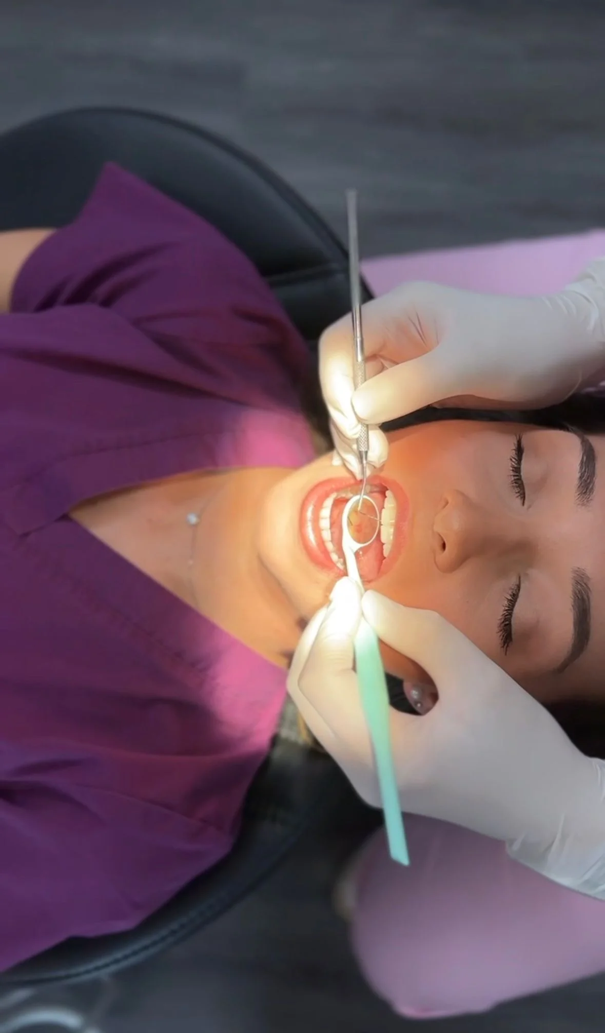 Dentální hygiena pro dospělé: odstranění plaku, zubního kamene a pigmentací