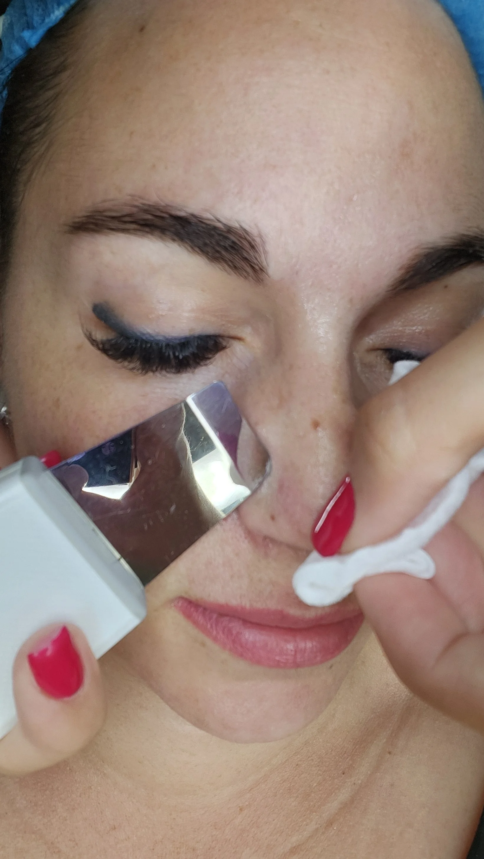 Kosmetická péče proti vráskám, akné i pigmentovým skvrnám: nanoneedling i biomicroneedling