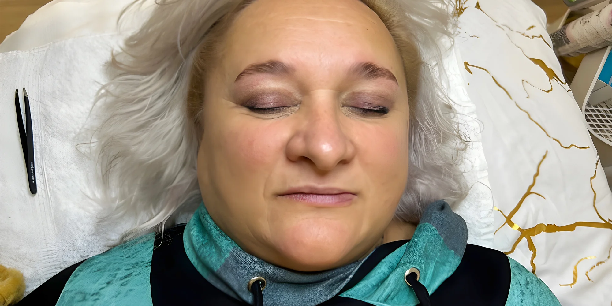 Mikrojehličkovaní pomocí Dermapen pro omlazení a obnovu pleti