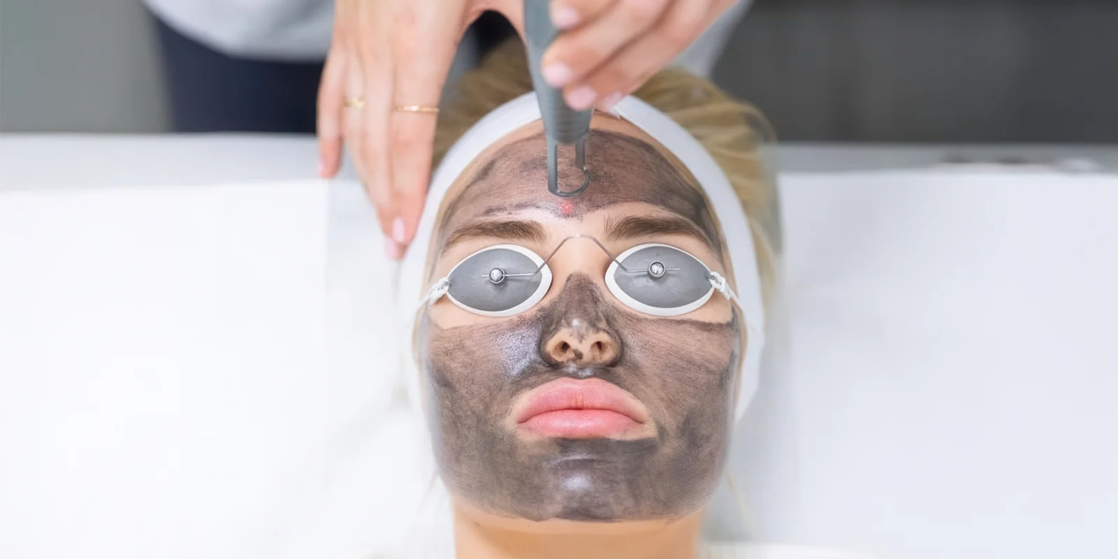 Peeling pro omlazení pleti: maska s aktivním uhlím a laserové ošetření