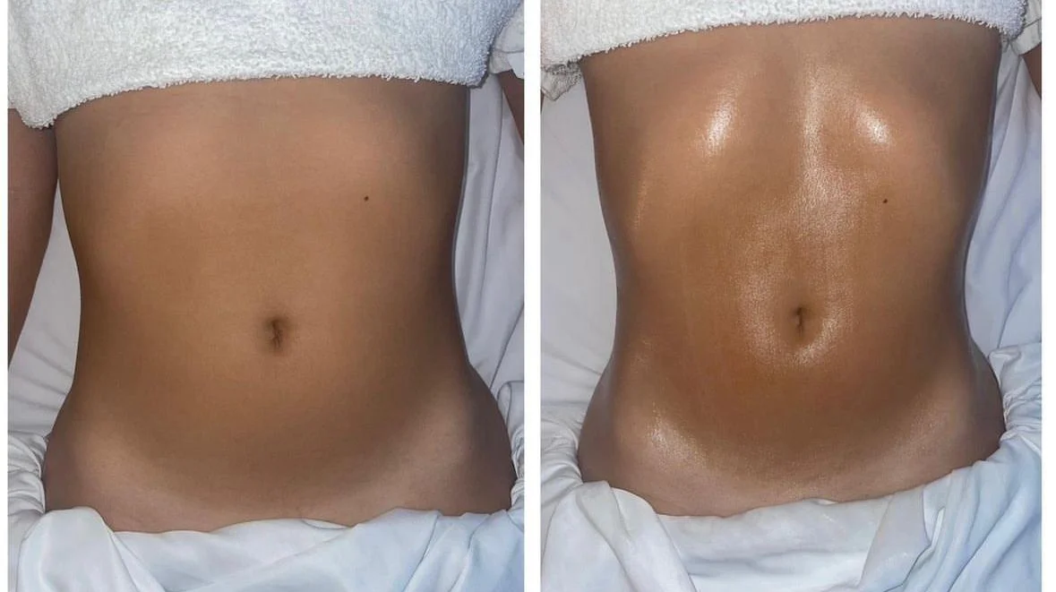 Hloubková péče o tělo: kolumbijská, brazilská maderoterapie i lymfomodelace