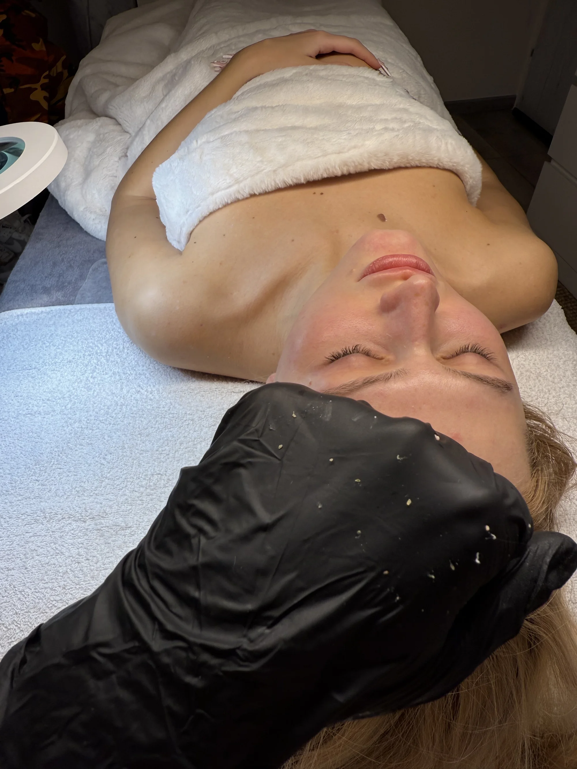 Kompletní péče o pleť: hloubkové čištění, peeling, masáž i mikrojehličkování