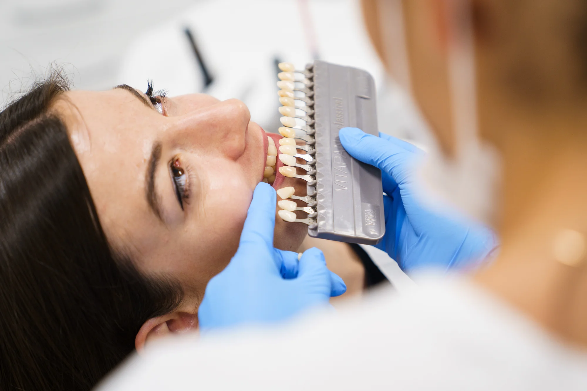 Ordinační bělení zubů LED lampou Philips Zoom s možností dentální hygieny