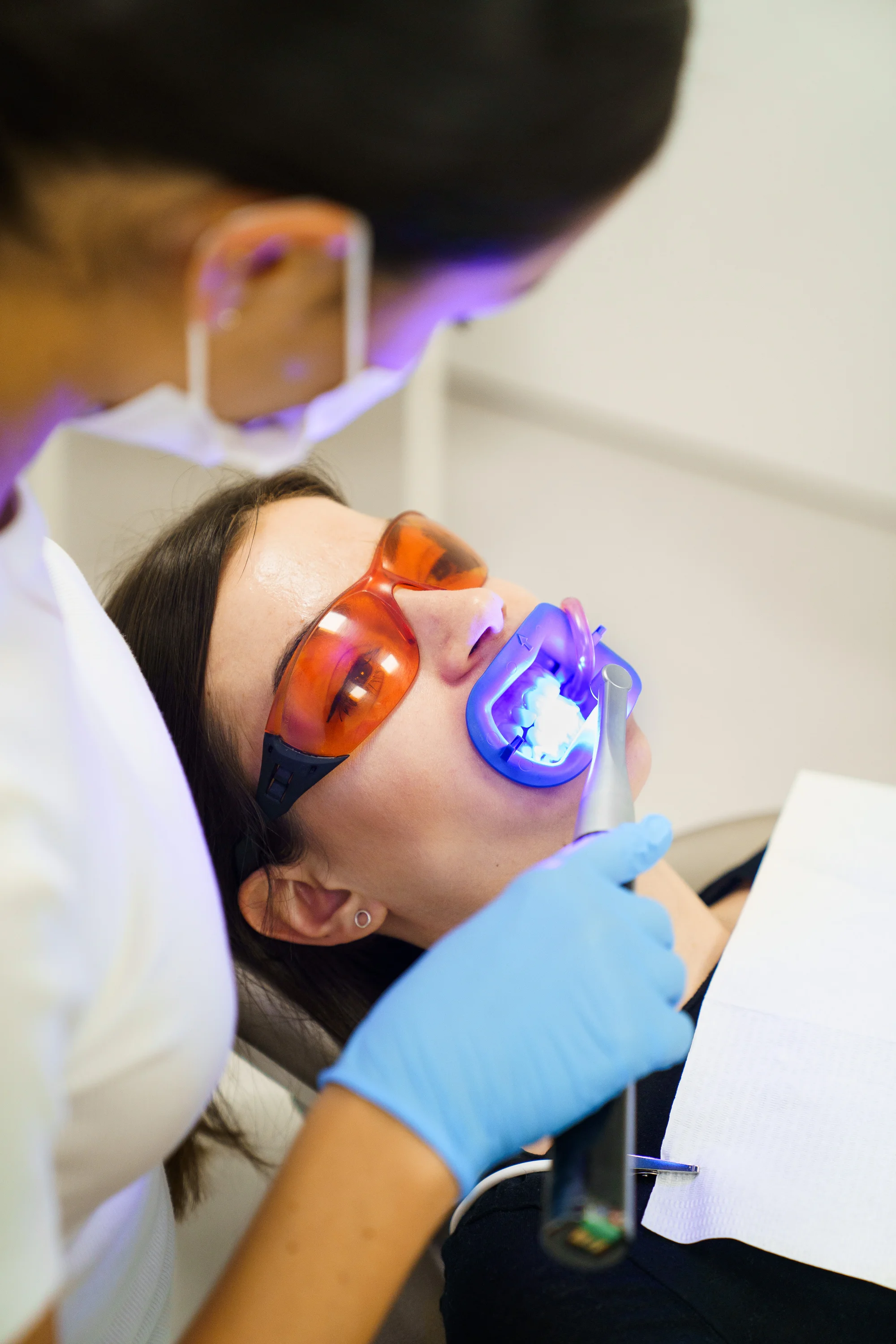 Ordinační bělení zubů LED lampou Philips Zoom s možností dentální hygieny