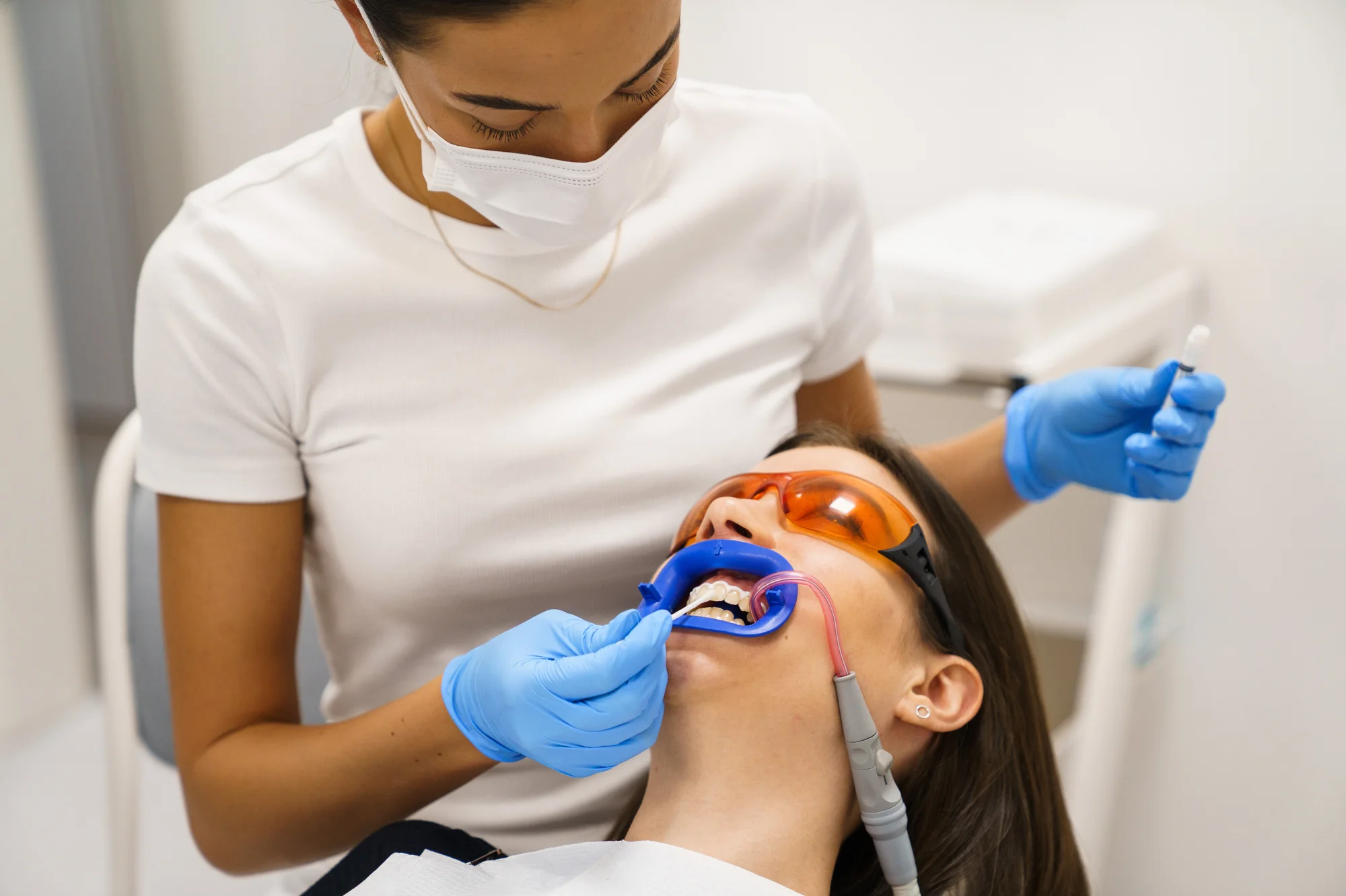 Ordinační bělení zubů LED lampou Philips Zoom s možností dentální hygieny