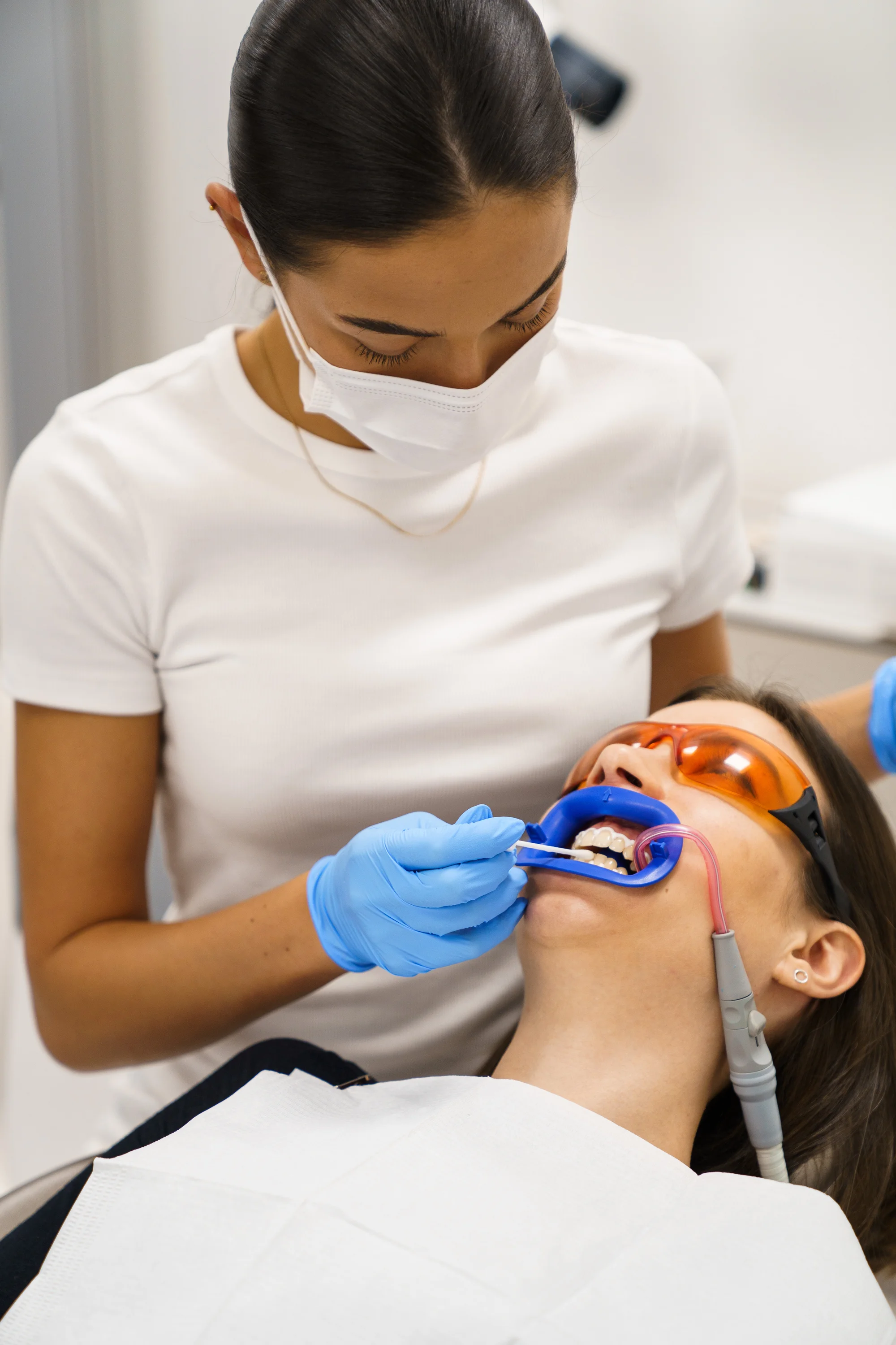 Ordinační bělení zubů LED lampou Philips Zoom s možností dentální hygieny