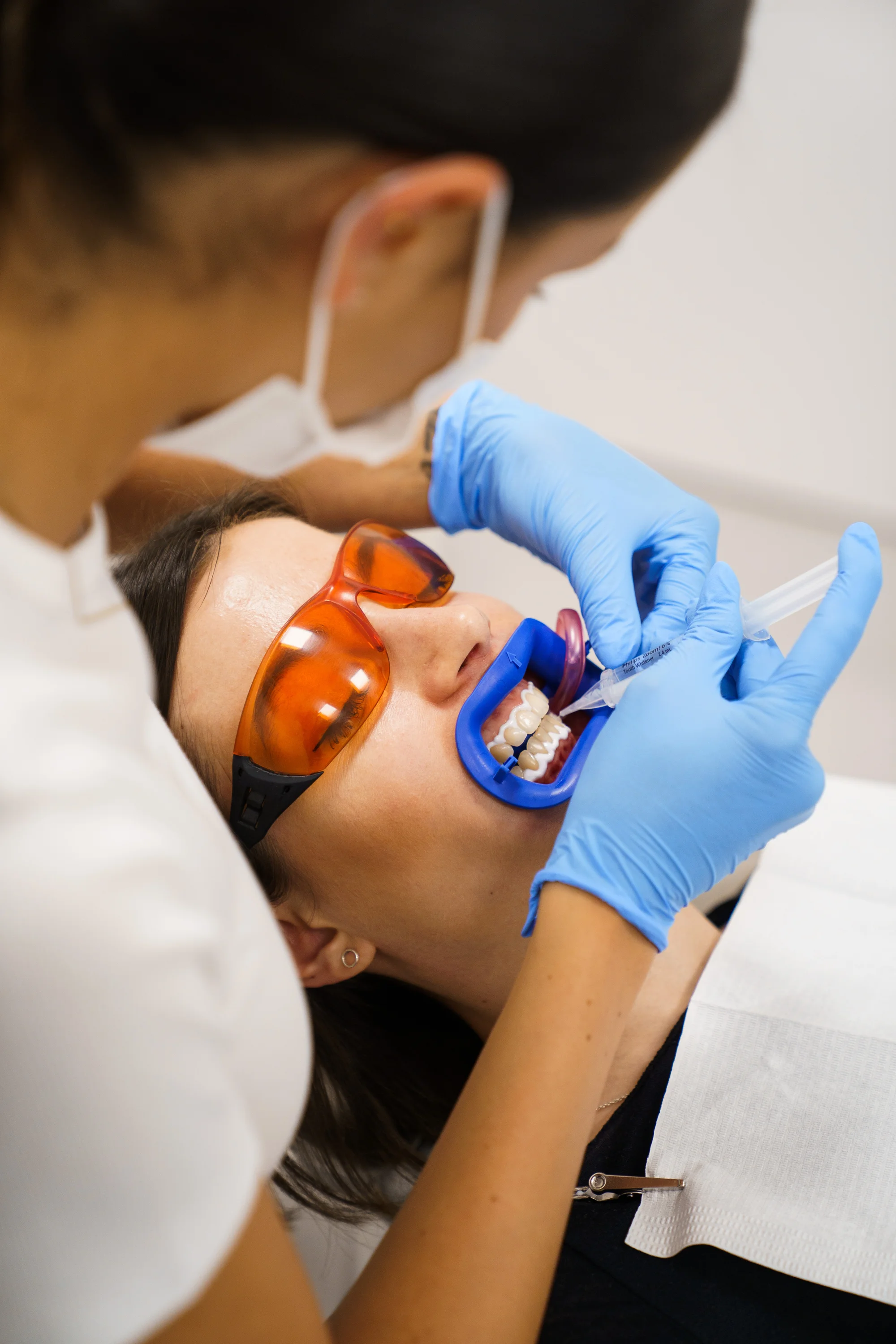 Ordinační bělení zubů LED lampou Philips Zoom s možností dentální hygieny