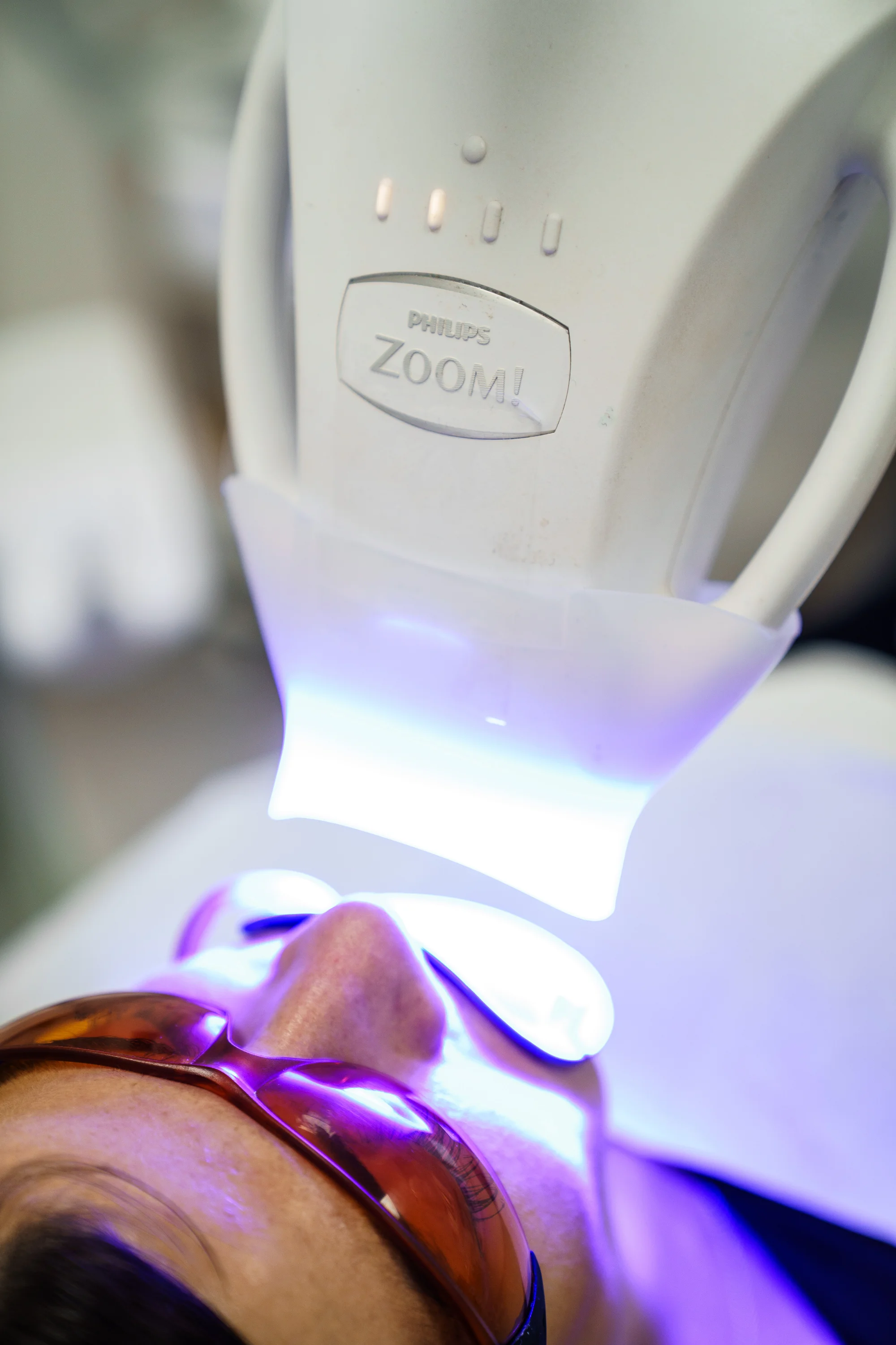 Ordinační bělení zubů LED lampou Philips Zoom s možností dentální hygieny