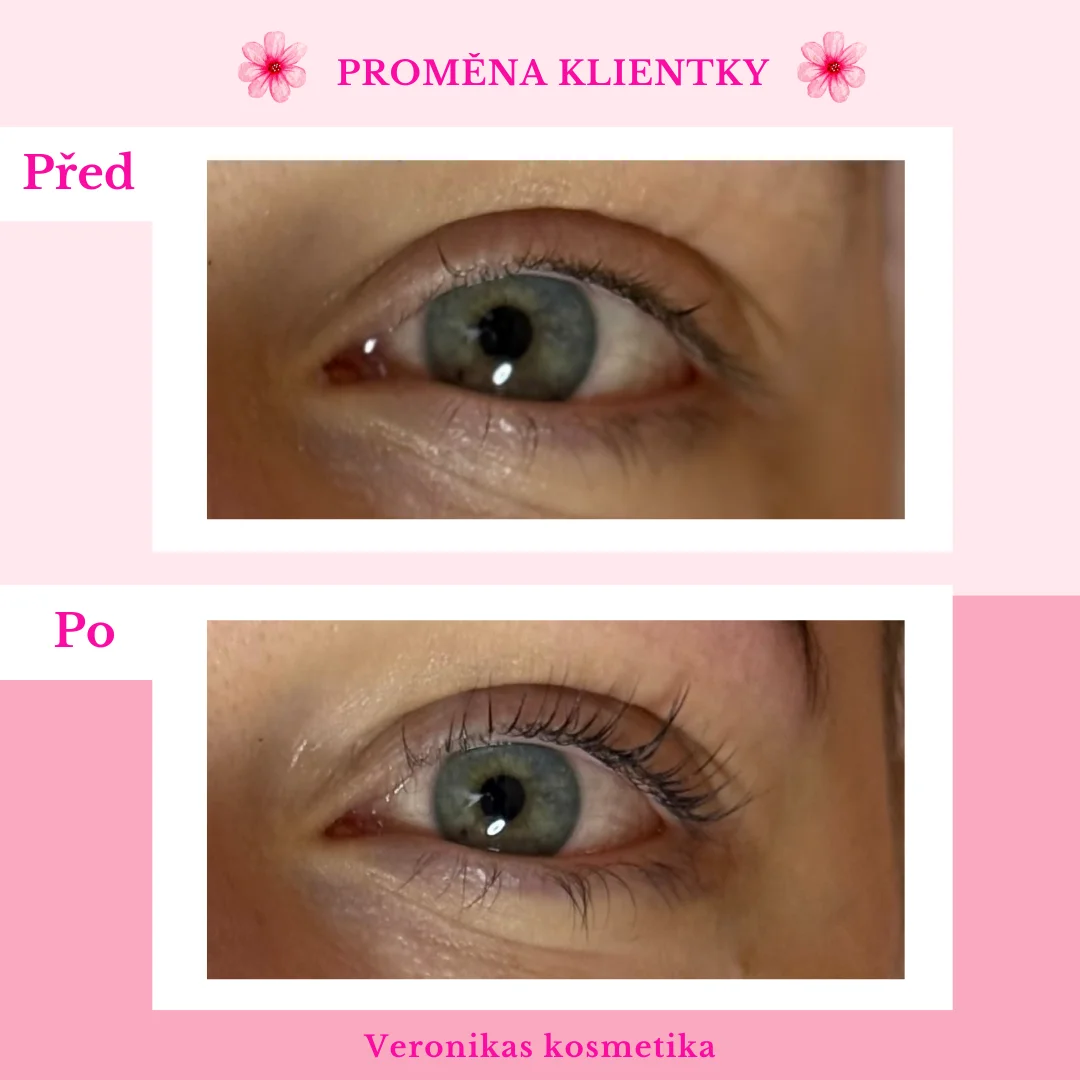 Ohromující pohled: laminace obočí, lash lifting či balíček obou procedur