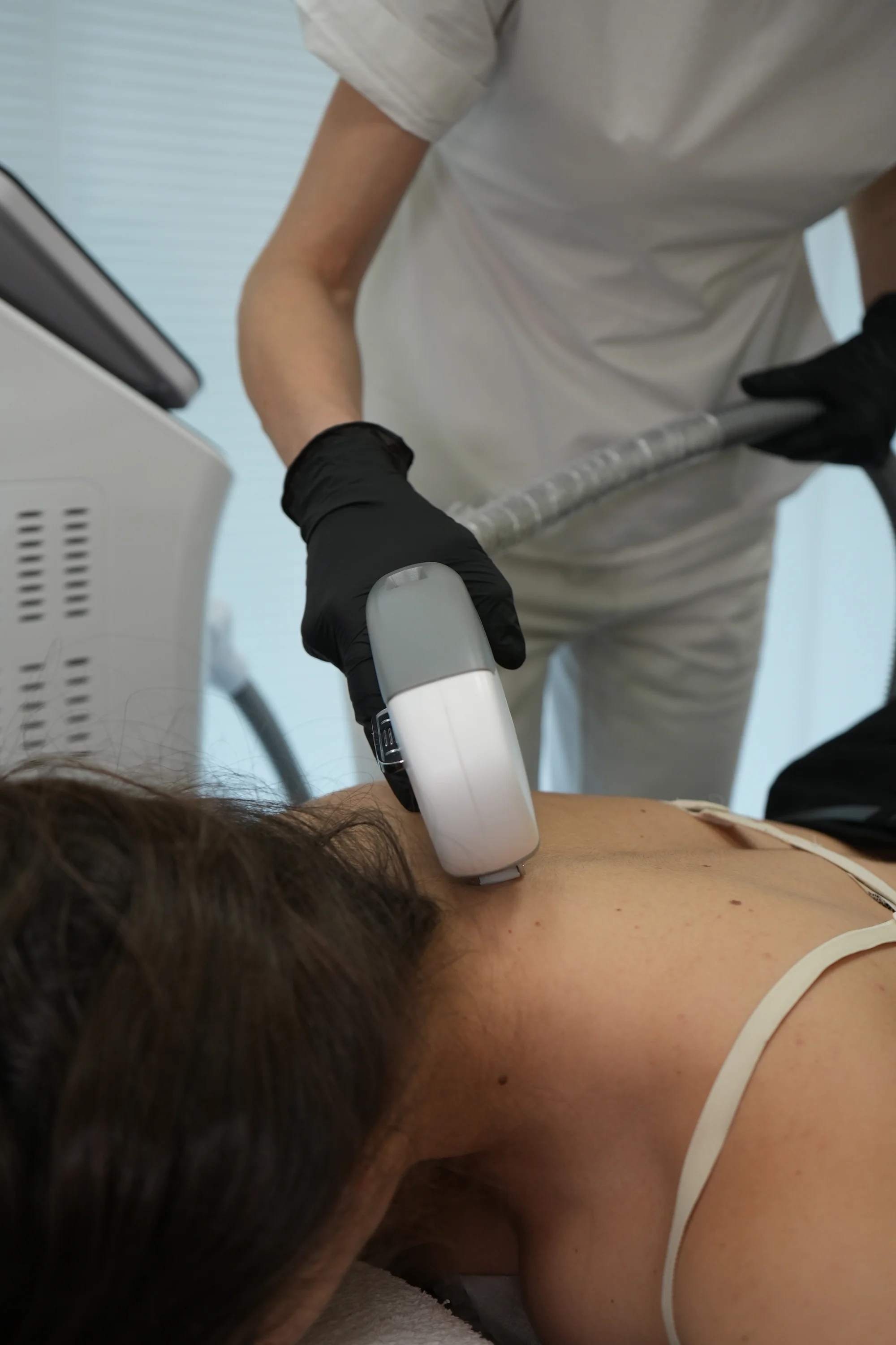 Ošetření AcneTherapy: účinný boj proti akné na obličeji, dekoltu i zádech