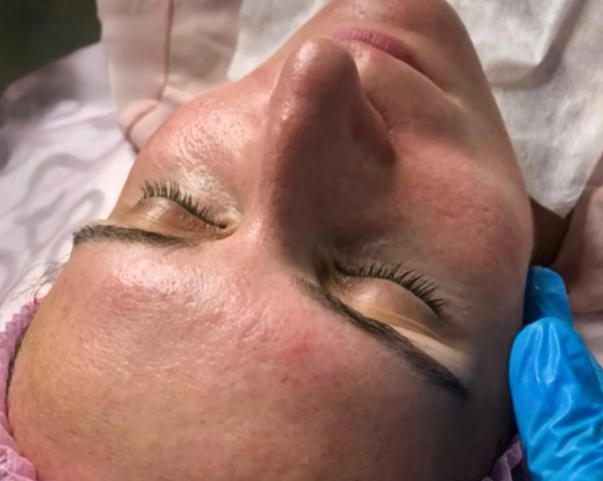 Kosmetické balíčky pro všechny typy pleti: hloubkové čištění i rozjasňující peeling
