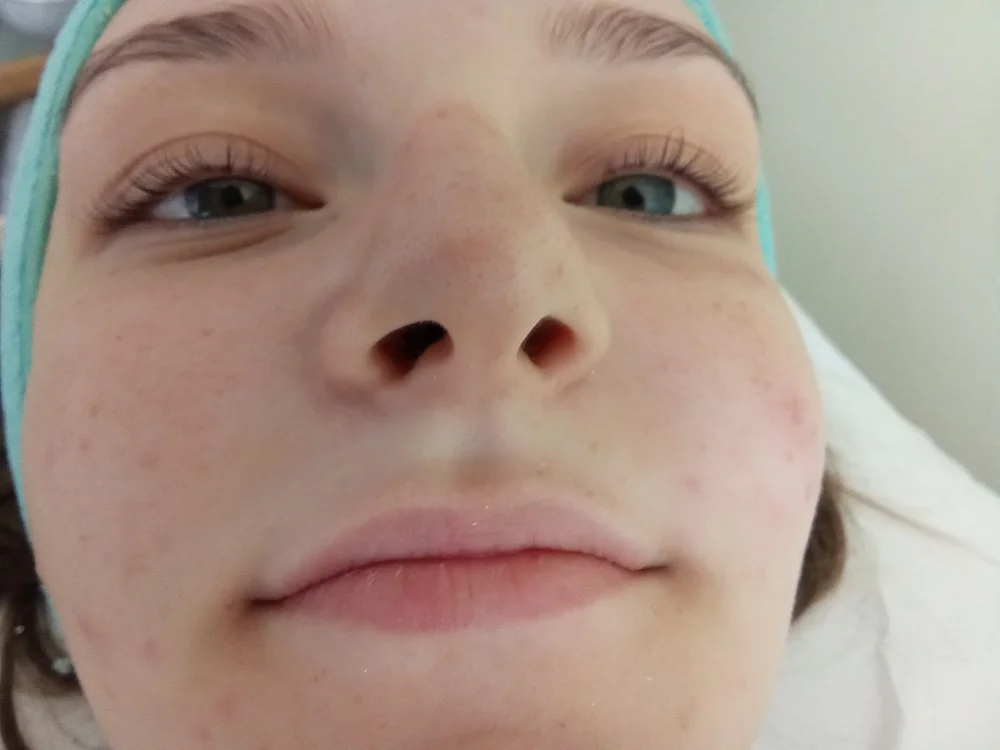 Laminace obočí, lash lifting nebo masáž obličeje a dekoltu