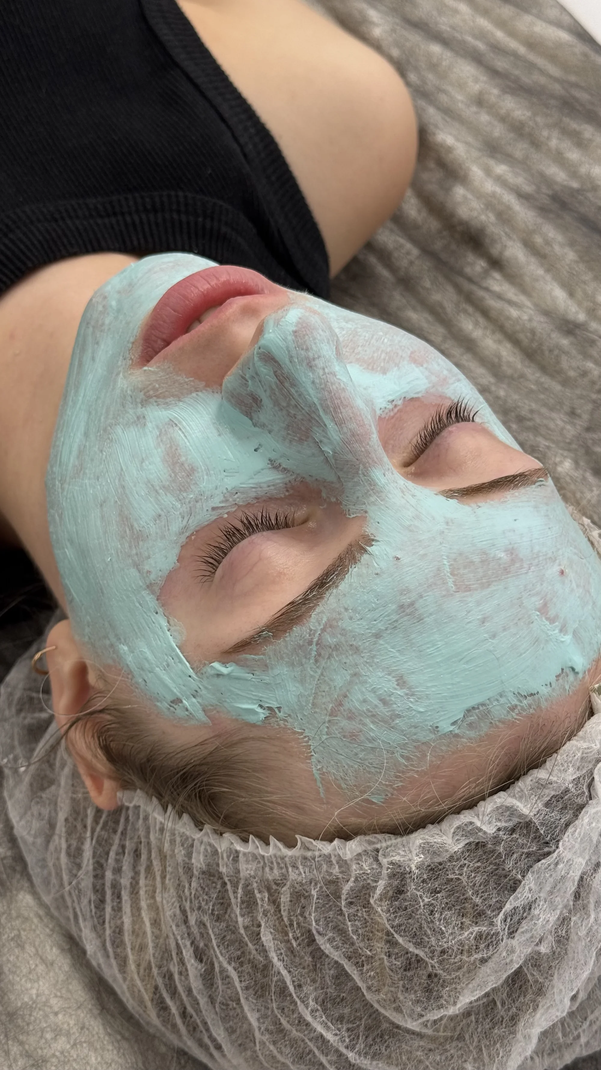 Kosmetické ošetření: ultrazvukové čistění, karboxyterapie, peeling i mikrojehličkování