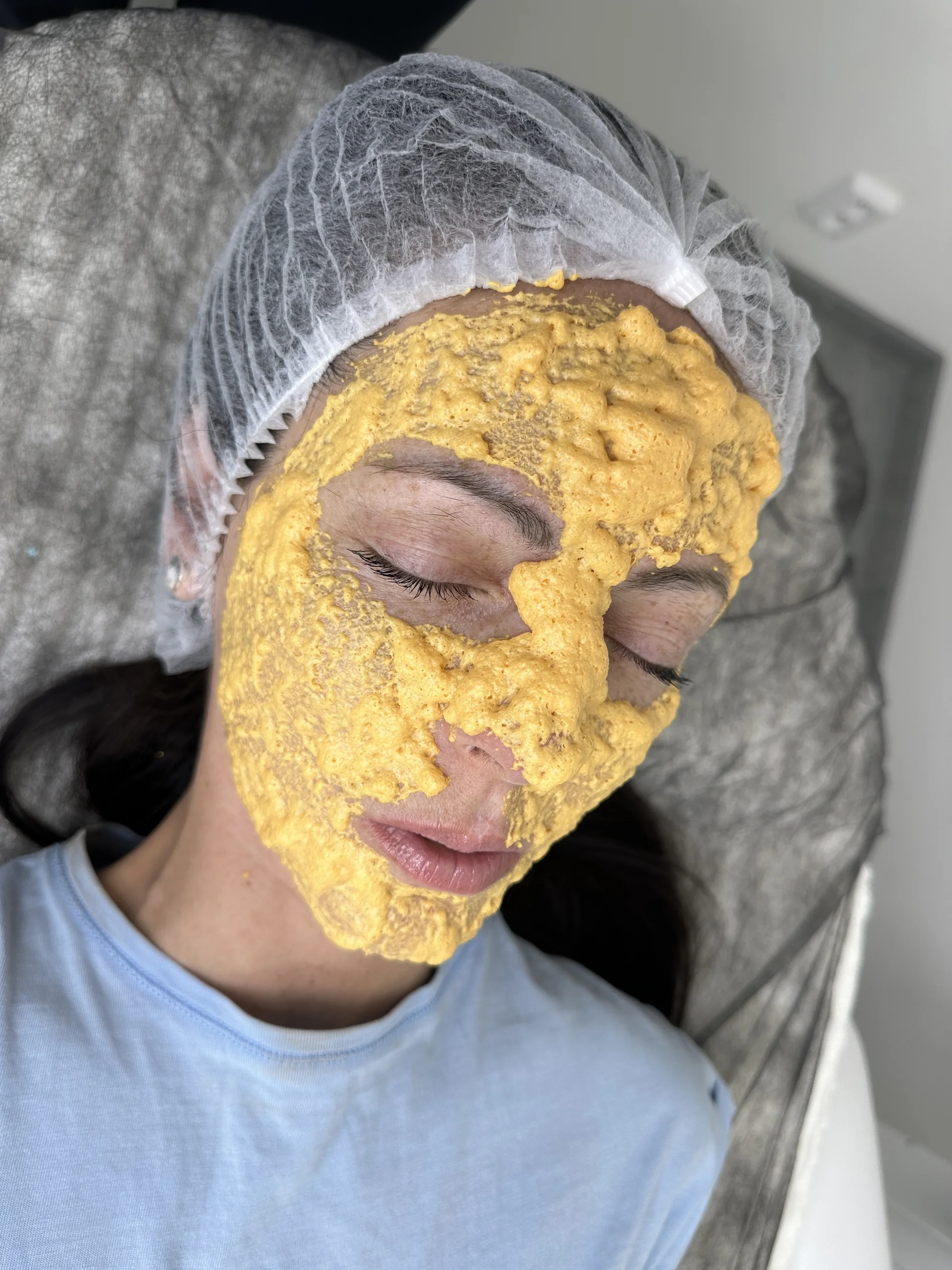 Kosmetické ošetření: ultrazvukové čistění, karboxyterapie, peeling i mikrojehličkování