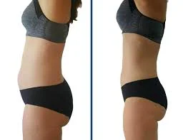 30 minut EMSzero: formování postavy bez cvičení