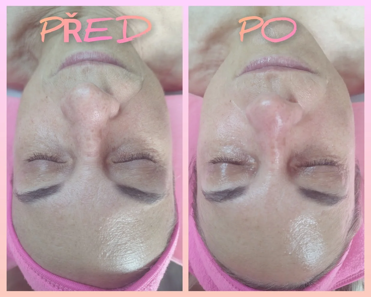 Kosmetické ošetření: diagnostika, čištění, peeling i masáž, 30–⁠⁠⁠⁠⁠⁠90 minut