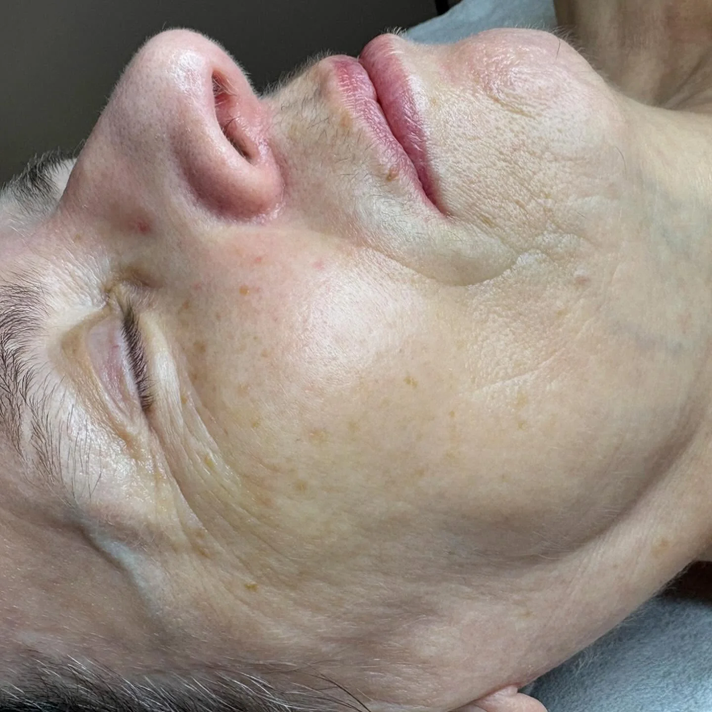 Kosmetické ošetření: diagnostika, čištění, peeling i masáž, 30–⁠⁠⁠⁠⁠⁠90 minut