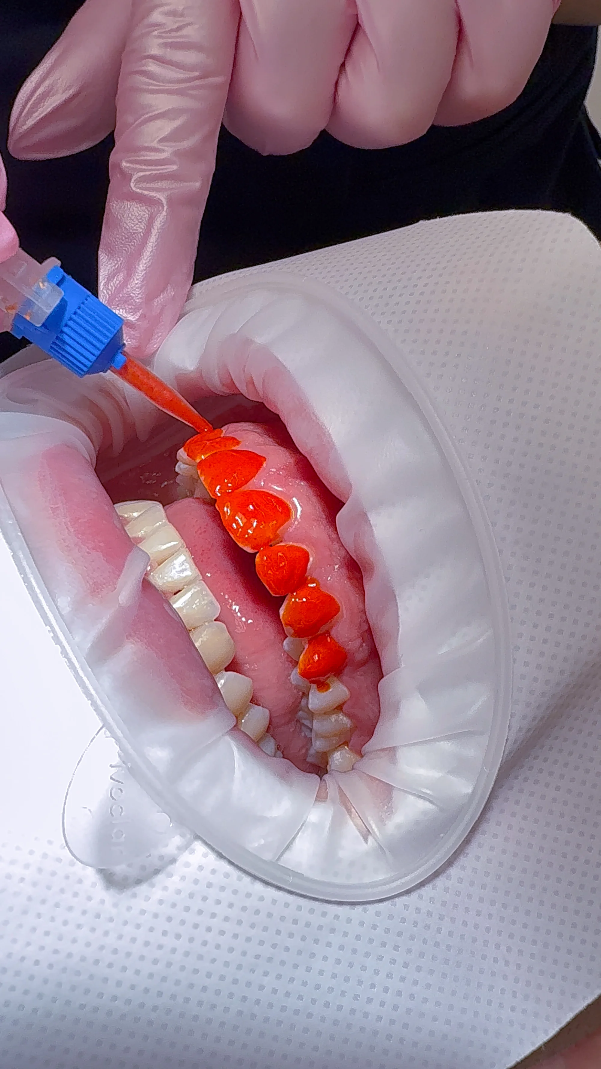 Zářivý úsměv během jedné návštěvy: vstupní dentální hygiena i bělení zubů, 60–⁠⁠⁠⁠⁠⁠120 minut