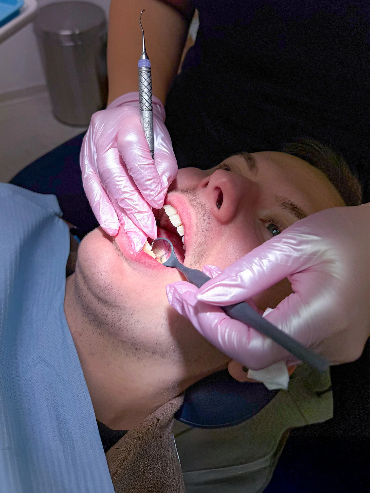 Zářivý úsměv během jedné návštěvy: vstupní dentální hygiena i bělení zubů, 60–⁠⁠⁠⁠⁠⁠120 minut