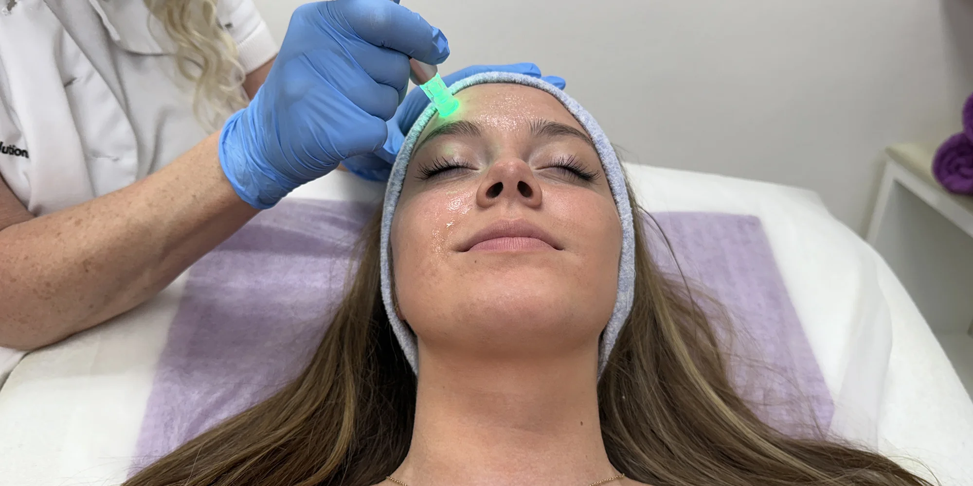 Kosmetická péče pro omlazení pleti: chemický peeling i mikrojehličkování, 1 až 3 ošetření