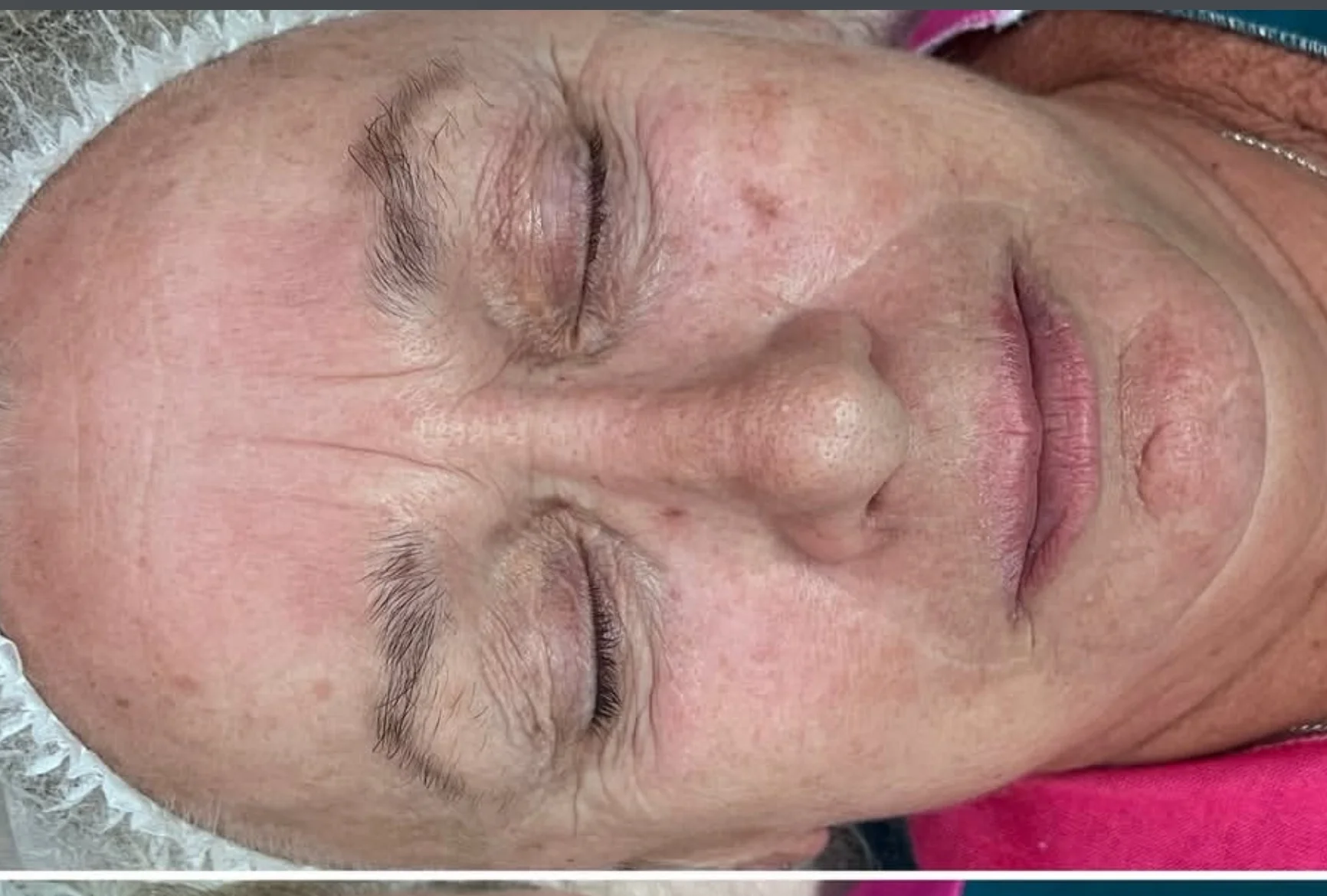 Dokonalá pleť: hydradermabraze i ve spojení s kosmetikou