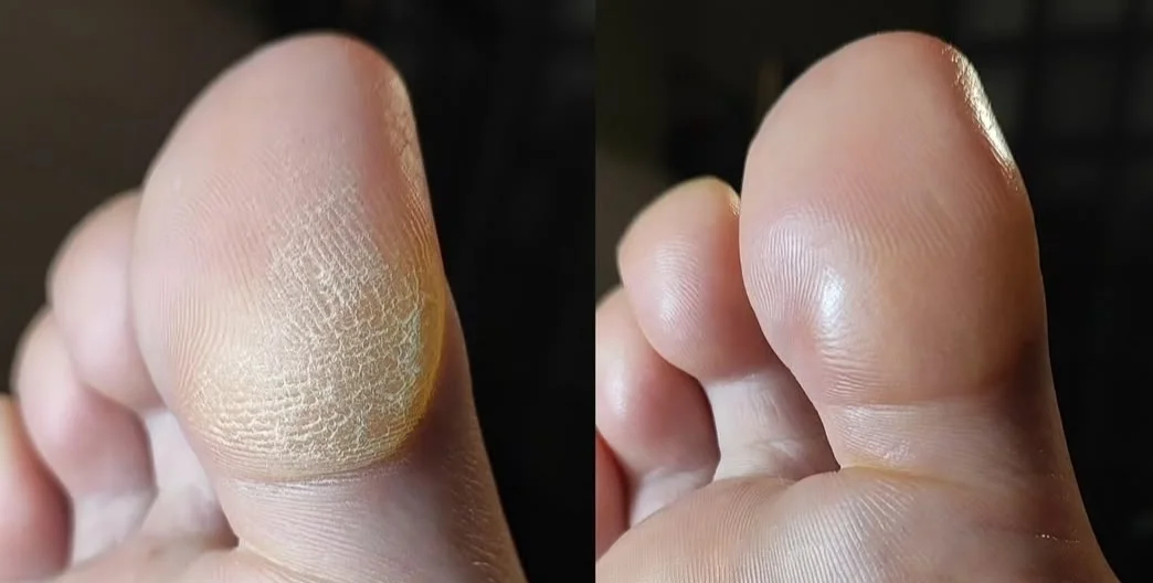 Pedikúra dle výběru: lázeň, P-Shine, peeling, masáž i aplikace laku