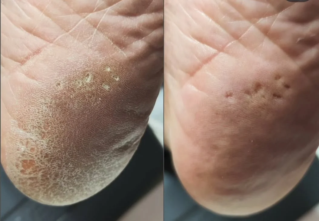 Pedikúra dle výběru: lázeň, P-Shine, peeling, masáž i aplikace laku