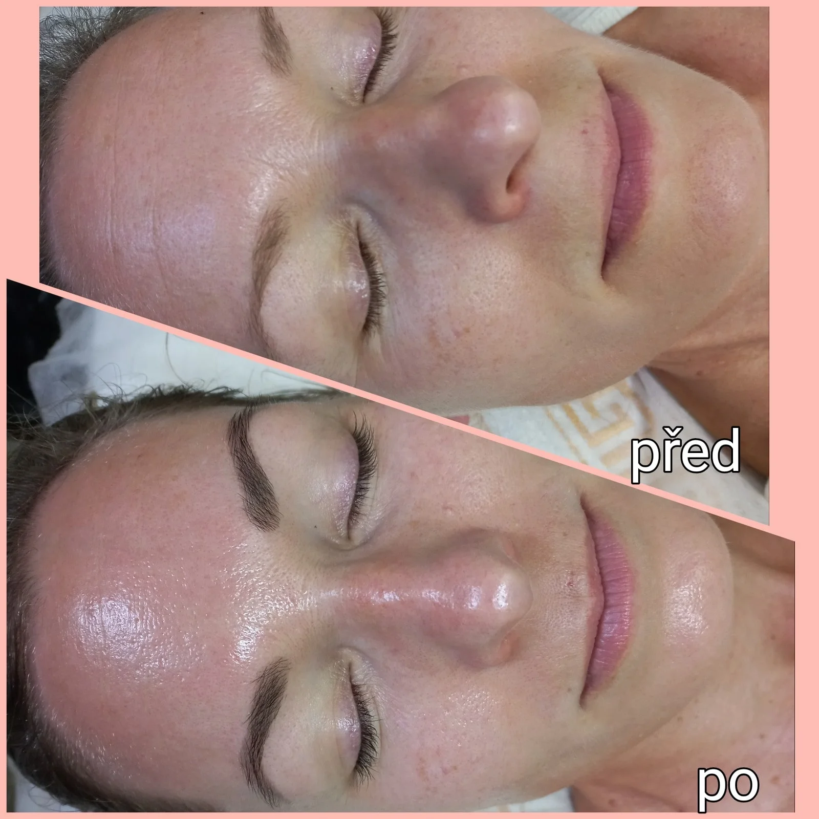 Vyberte si svou dávku krásy: Lifting řas, laminace, peeling i zábal na ruce