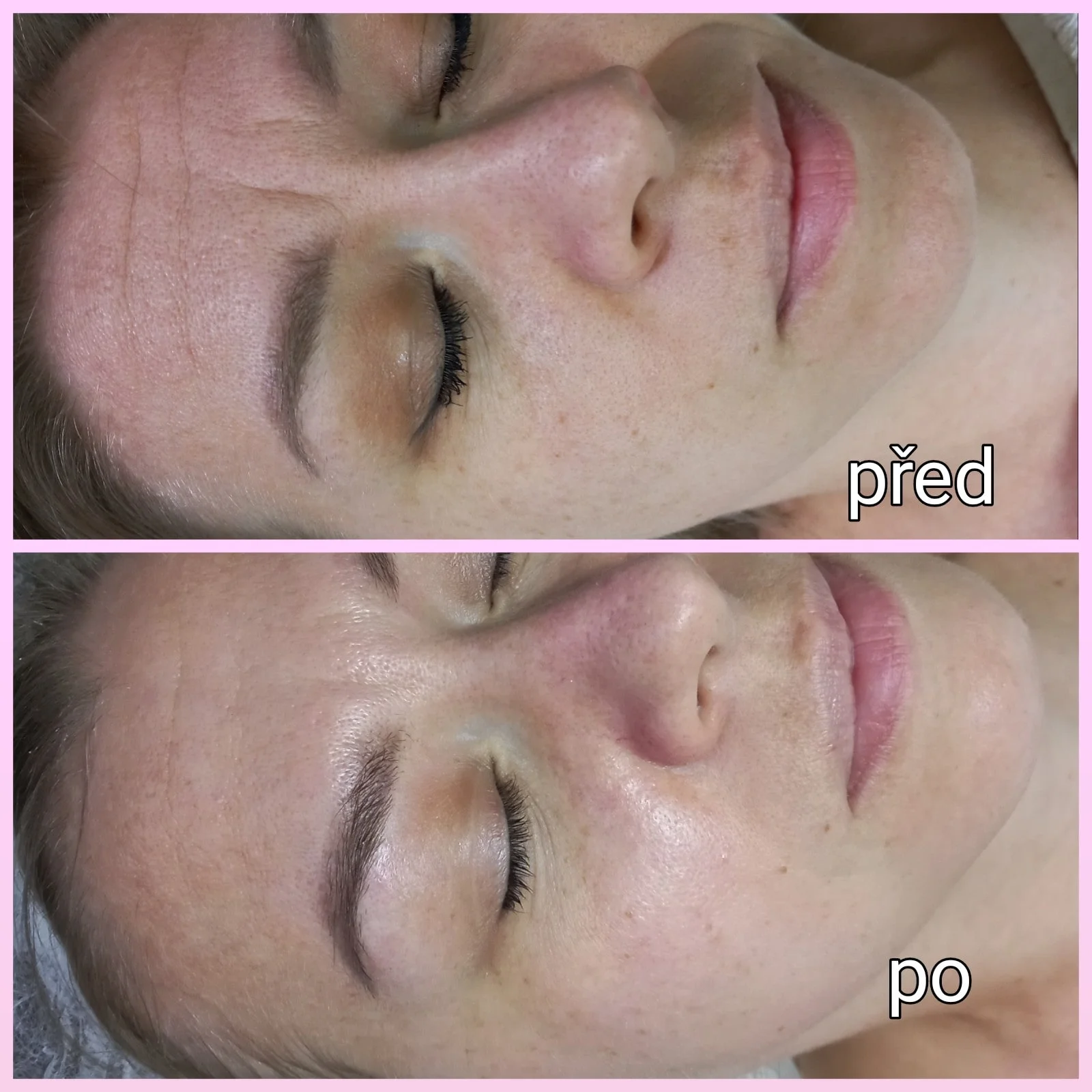 Vyberte si svou dávku krásy: Lifting řas, laminace, peeling i zábal na ruce