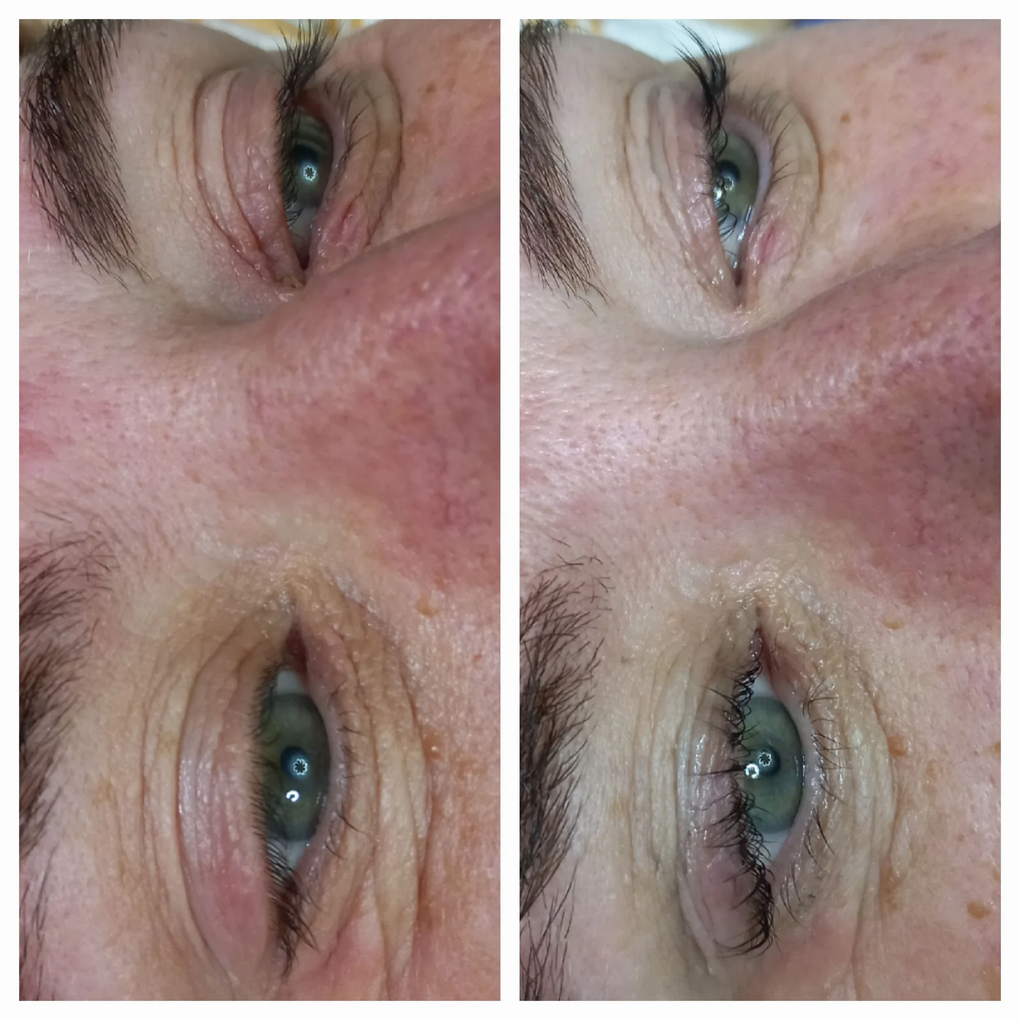 Vyberte si svou dávku krásy: Lifting řas, laminace, peeling i zábal na ruce