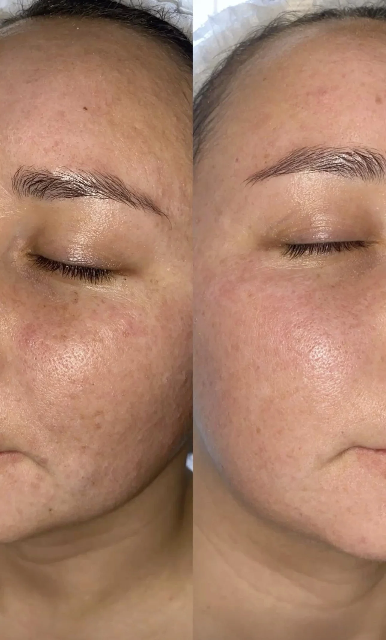 Pleť v nejlepší kondici: anti-age ošetření, bioenzymová terapie či mezoterapie