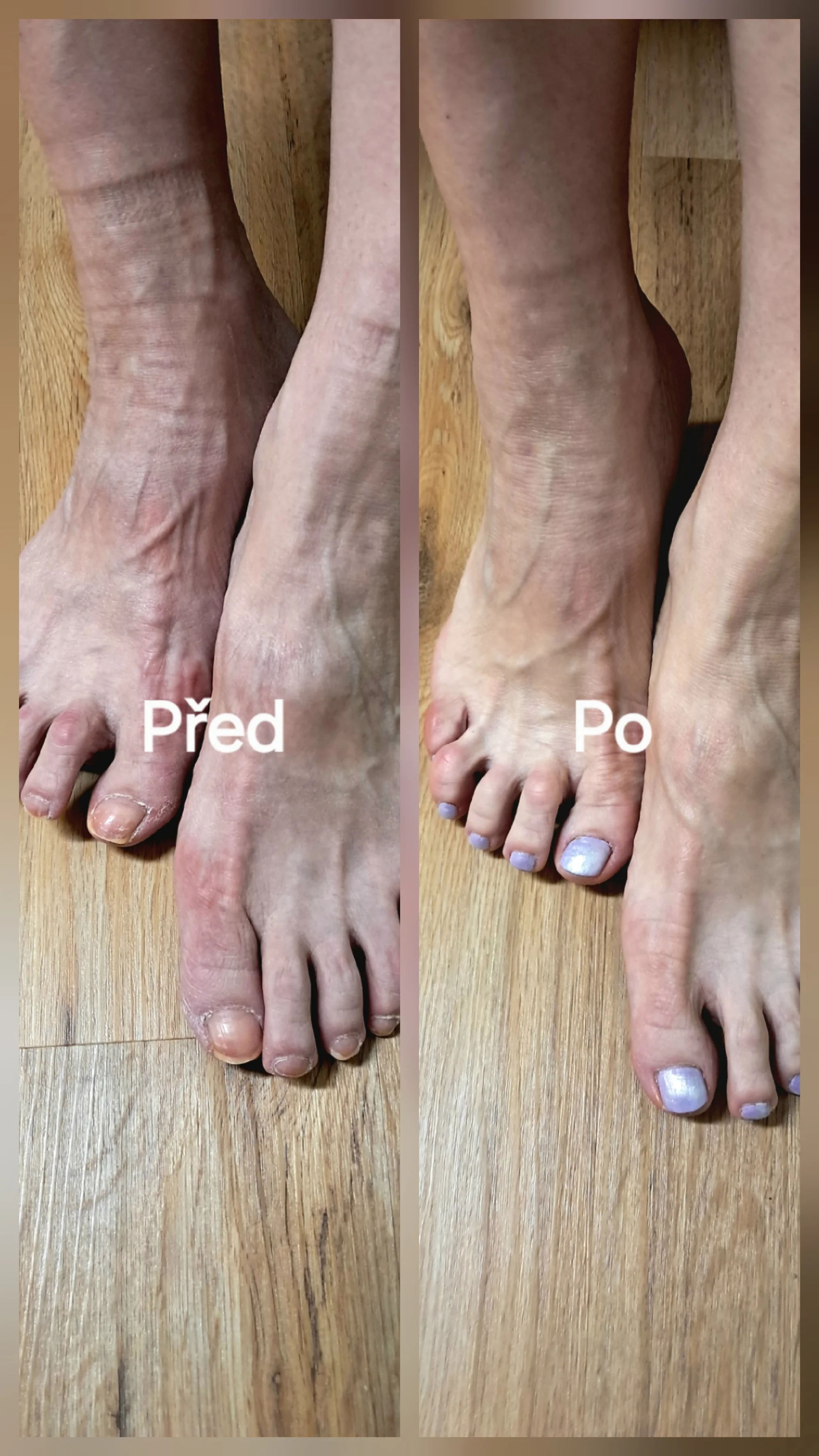 Kompletní mokrá pedikúra s lakováním nebo odolným Shellacem
