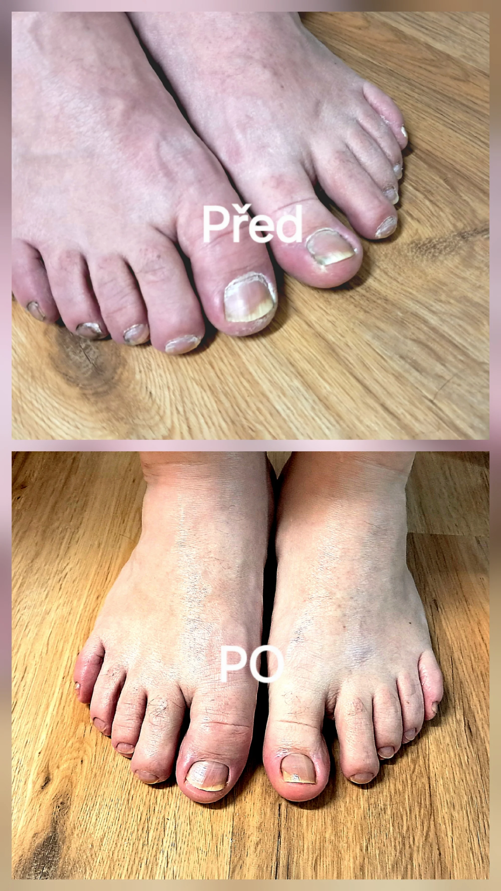 Kompletní mokrá pedikúra s lakováním nebo odolným Shellacem