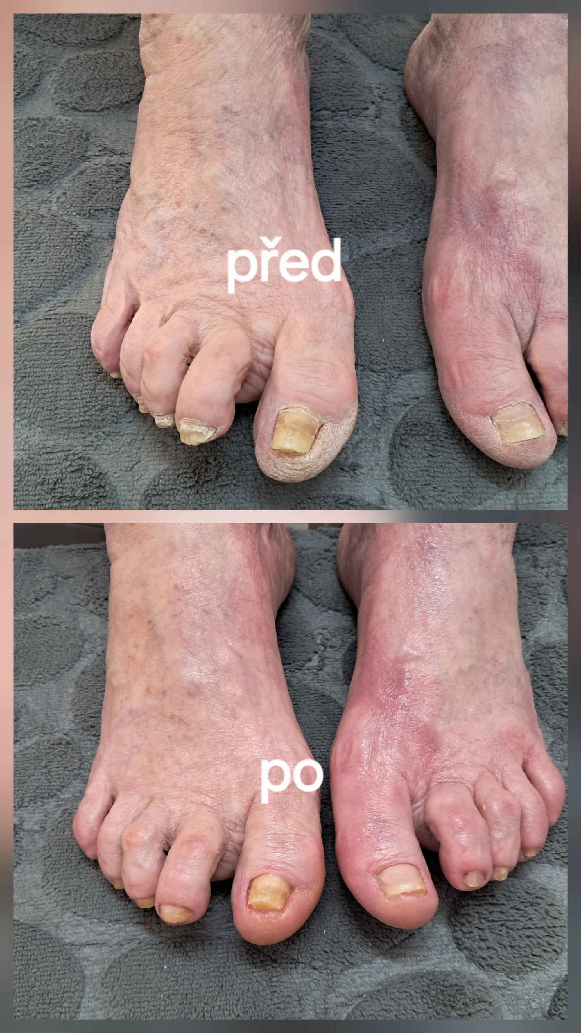 Kompletní mokrá pedikúra s lakováním nebo odolným Shellacem